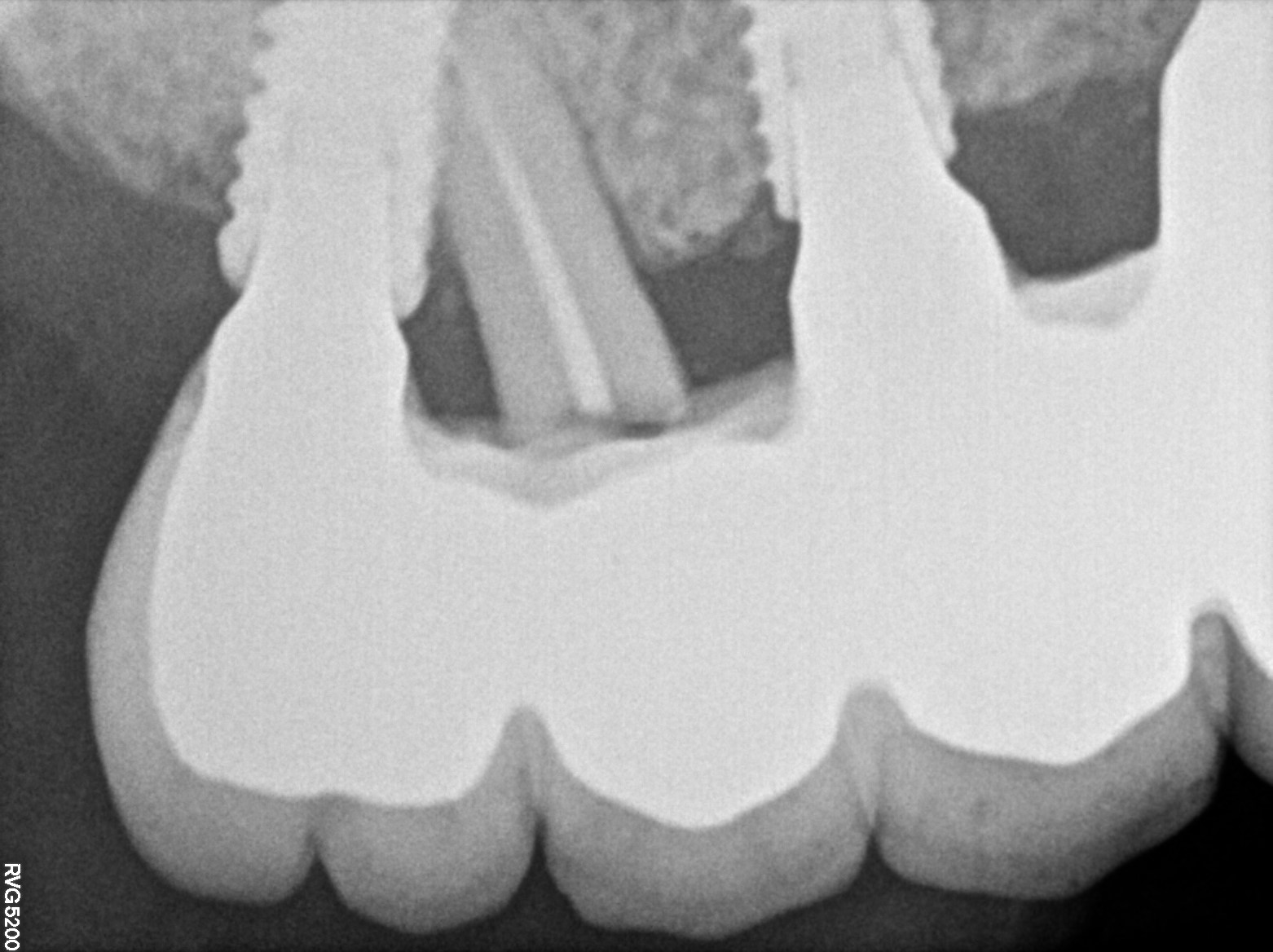 Dental X-ray